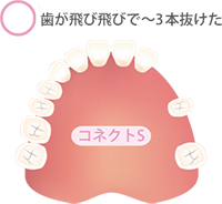 コネクトS コネクトM