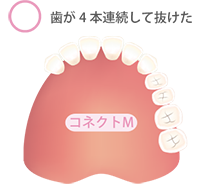 コネクトS コネクトM