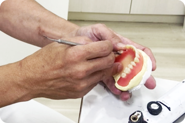 パイロットデンチャーの調整