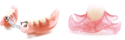 入れ歯のお悩みその1 入れ歯の金具が目立つ