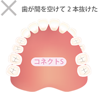 ソケット ソケットプラス